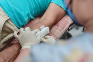What Is the Case Value for a Dog Bite That Causes Facial Scars? | Denver Injury Lawyer