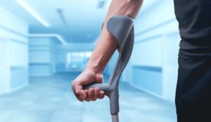 Un hombre camina con muletas. Un abogado de accidentes de camiones en Phoenix puede maximizar su compensación y proteger sus derechos contra las grandes compañías de camiones.