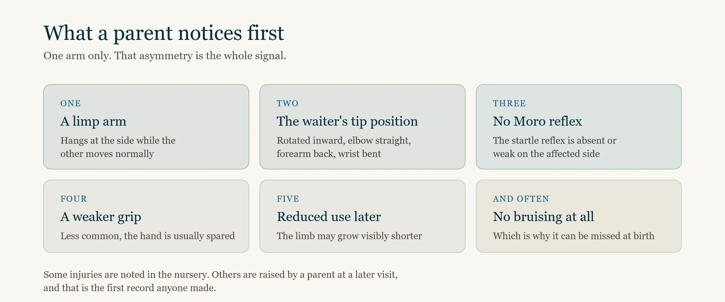 Checklist of the visible signs of Erb's palsy in a newborn, including a limp arm, the waiter's tip position, an absent Moro reflex on one side, and reduced grip