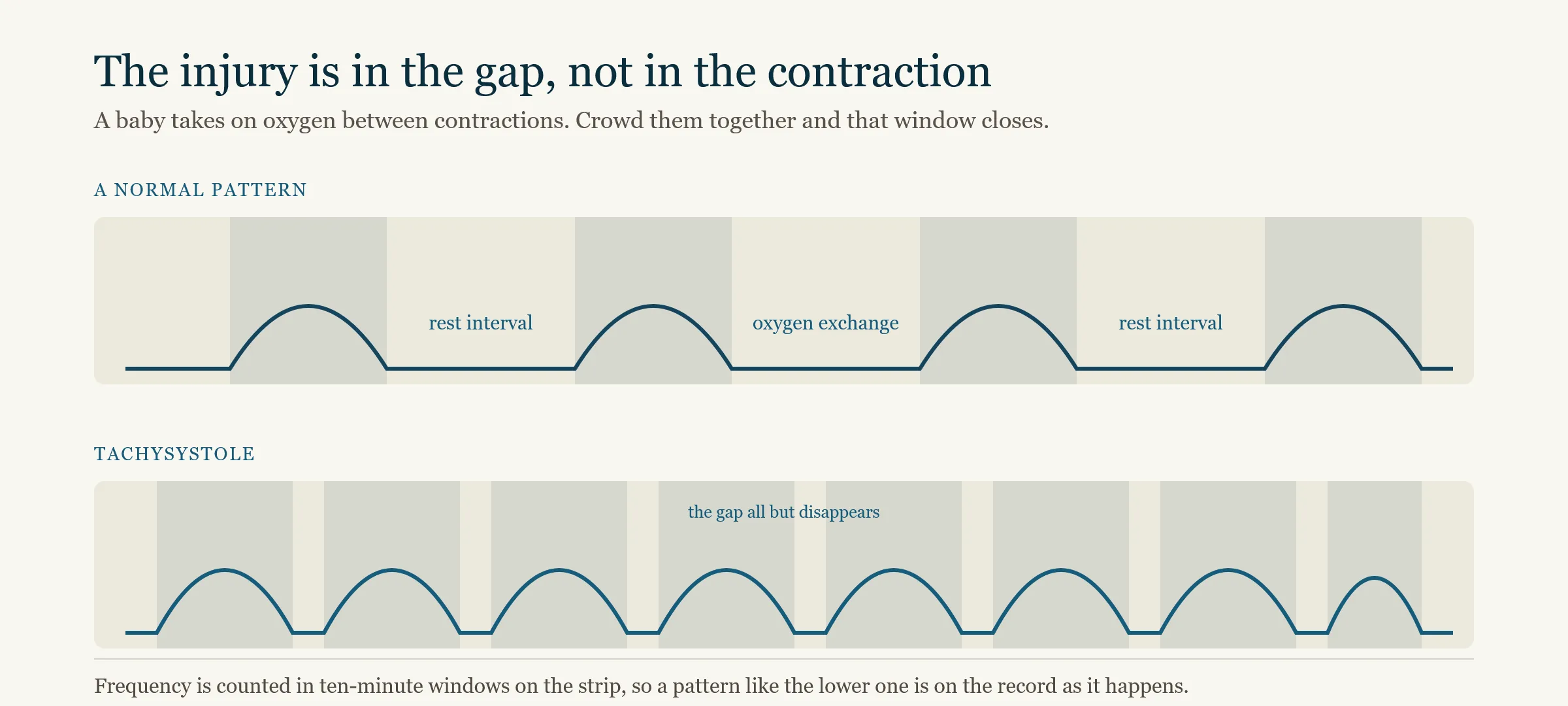 Two contraction tracings compared: a normal pattern with a long rest interval between contractions where oxygen exchange happens, and a tachysystole pattern where the contractions crowd together and the rest interval nearly disappears